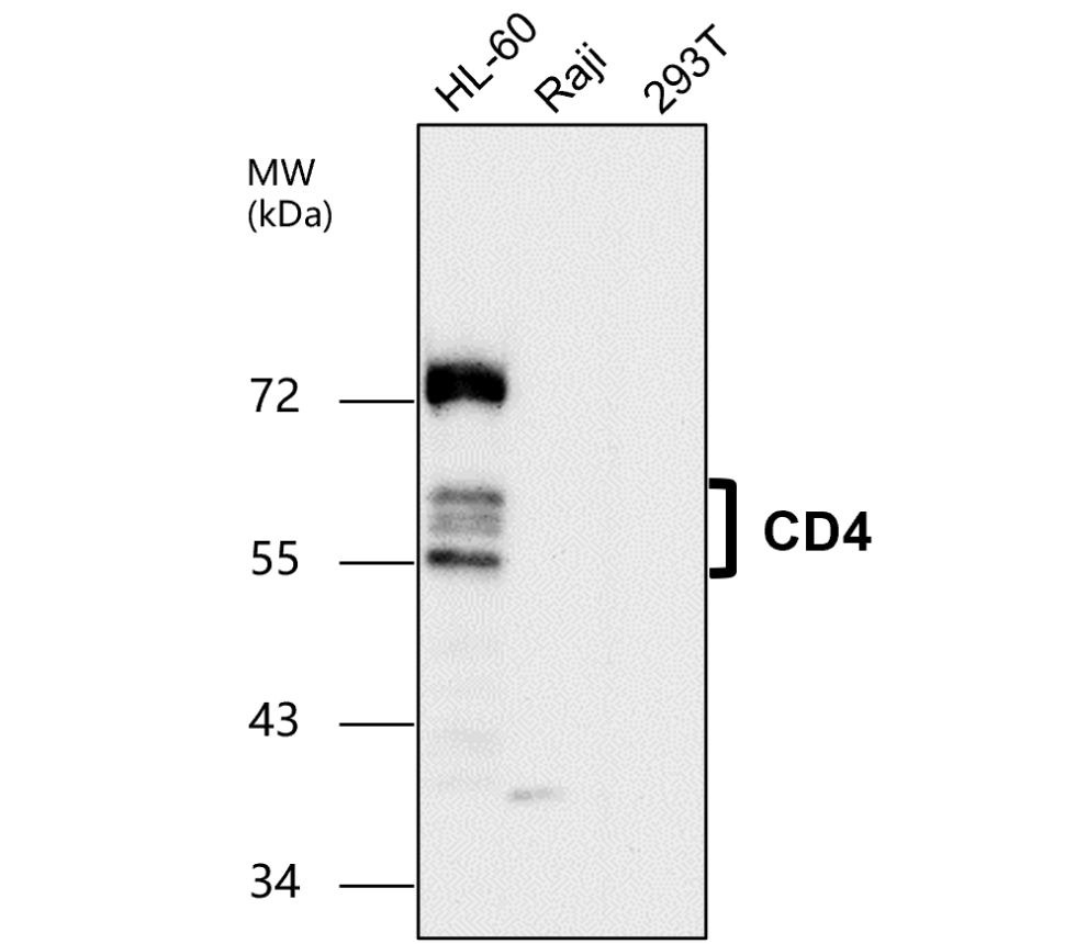 IR 250-898 anti-CD4 antibody WB image IR 250-898 anti-CD4 antibody WB image