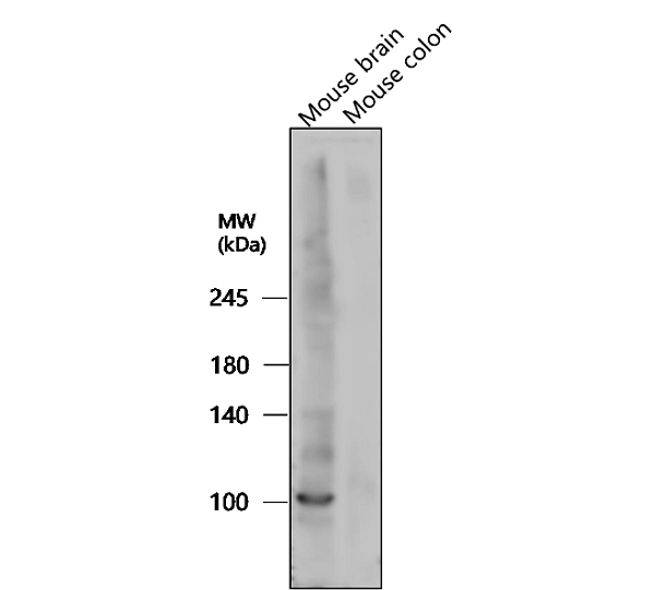 IR38-119 anti-LRRK2 antibody WB image IR38-119 anti-LRRK2 antibody WB image