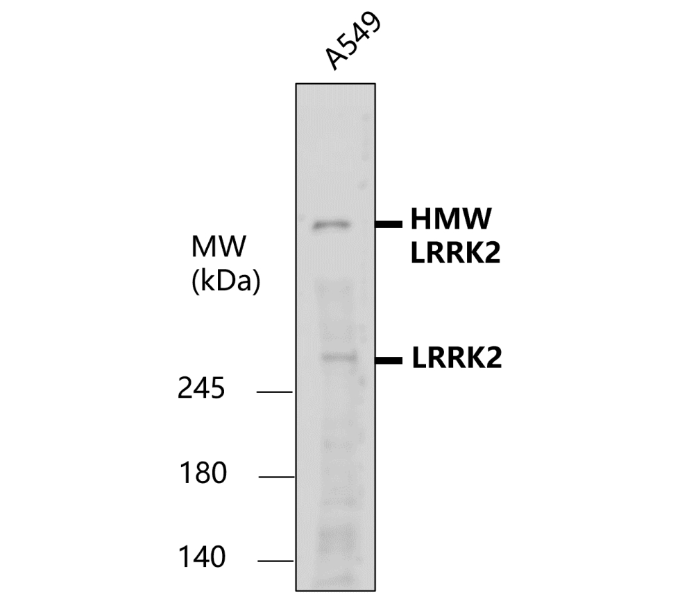 IR38-119 anti-LRRK2 antibody WB image IR38-119 anti-LRRK2 antibody WB image