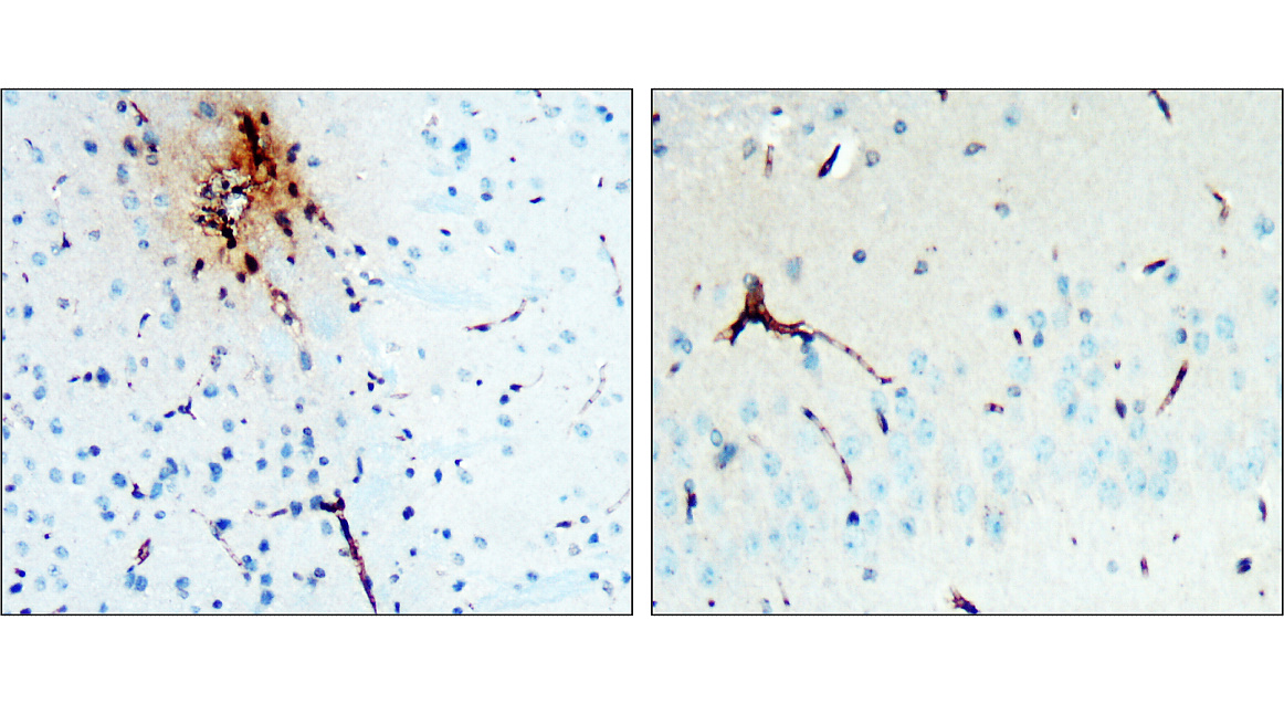 IR38-119 anti-LRRK2 antibody IHC image IR38-119 anti-LRRK2 antibody IHC image