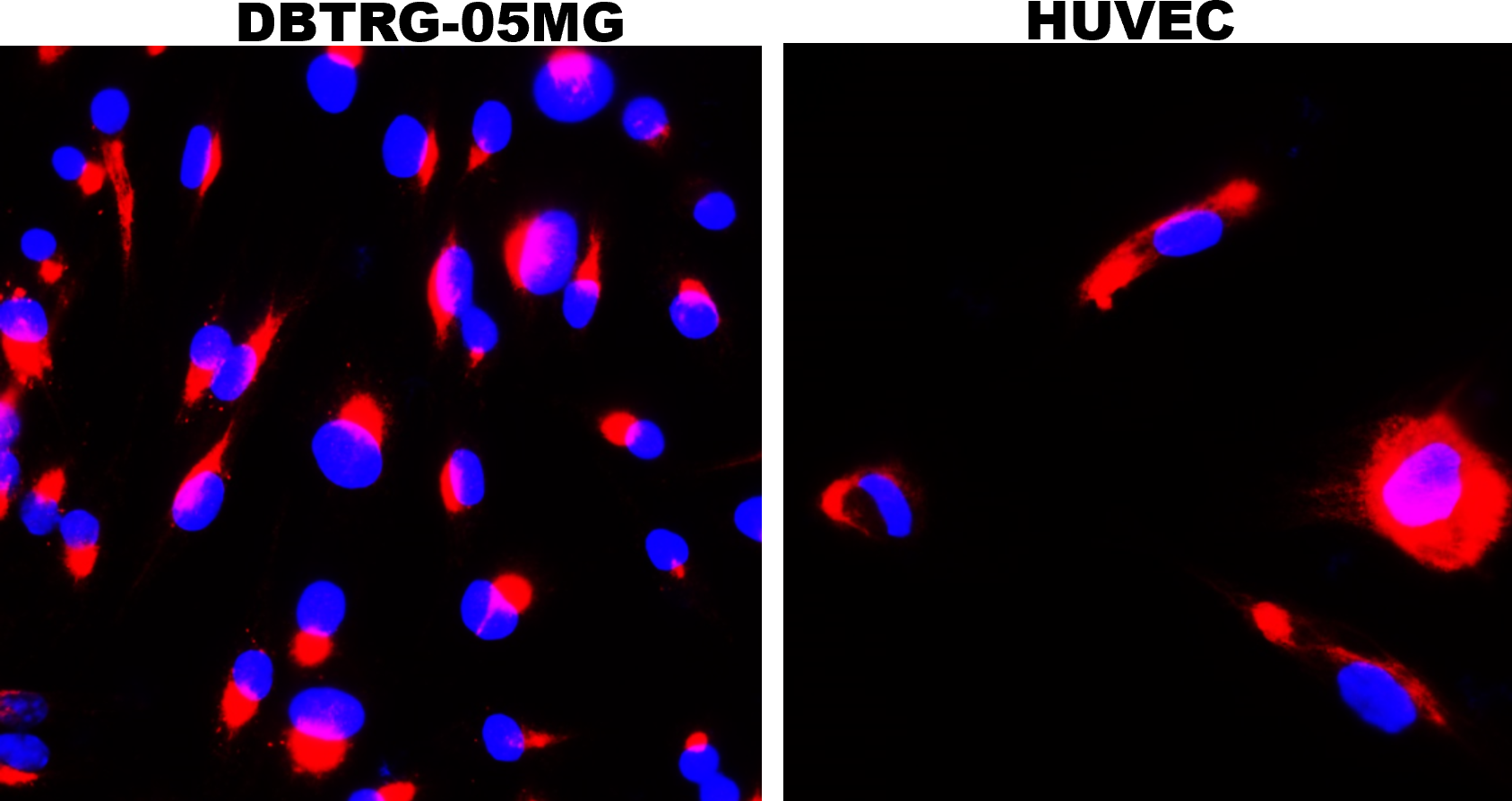 IR38-119 anti-LRRK2 antibody ICC/IF image IR38-119 anti-LRRK2 antibody ICC/IF image
