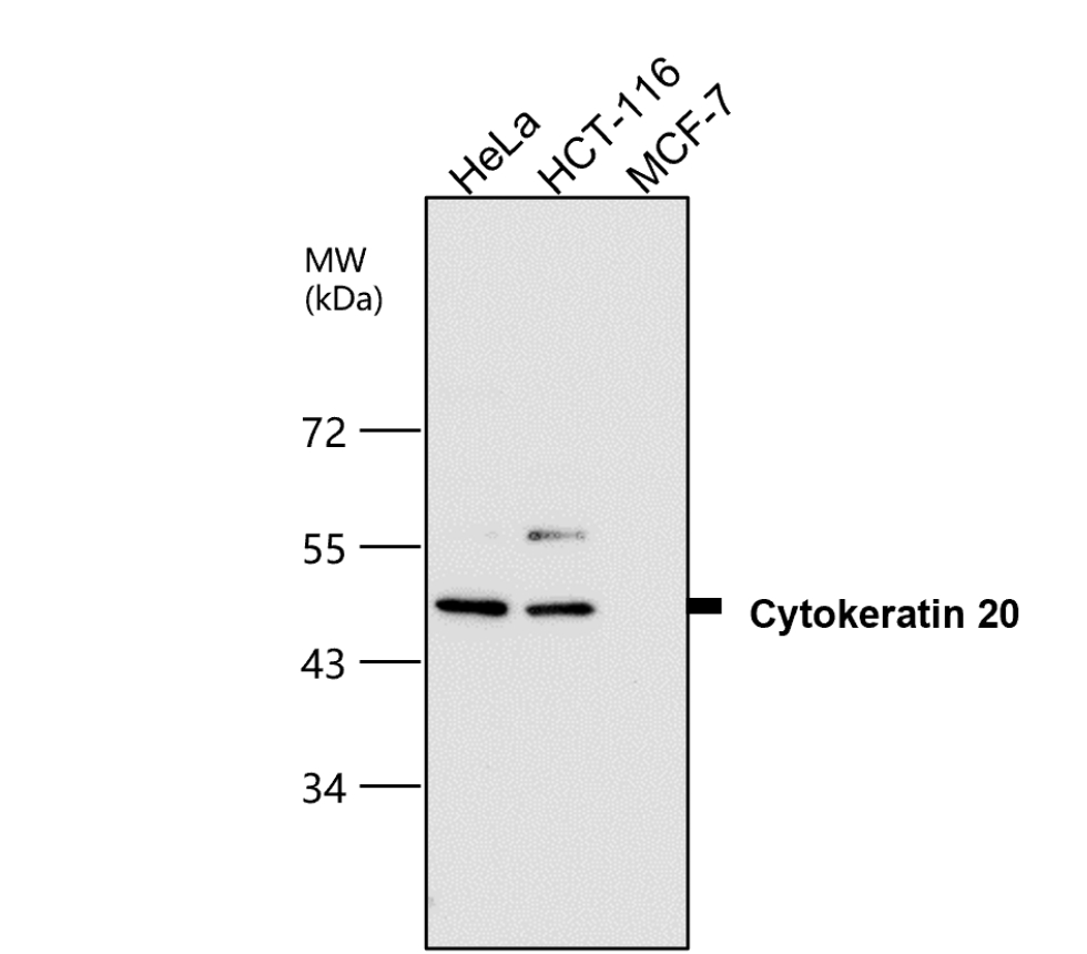 IR238-892 anti-Cytokeratin 20 antibody WB image IR238-892 anti-Cytokeratin 20 antibody WB image