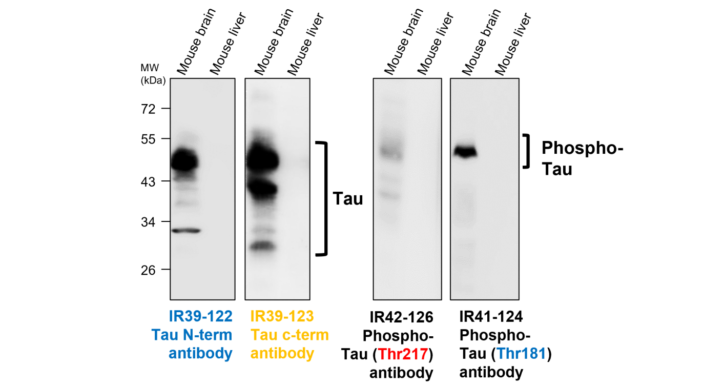 IR39-122 anti-Tau N-term antibody WB image IR39-122 anti-Tau N-term antibody WB image