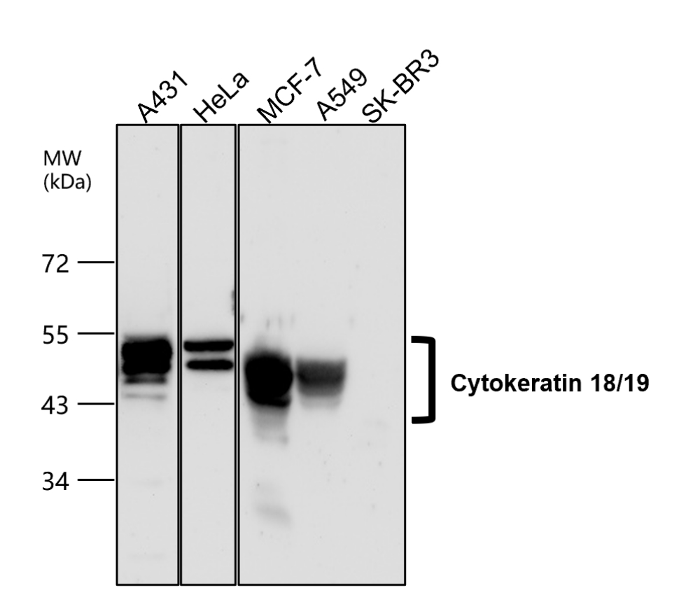 IR236-890 anti-Cytokeratin 18/19 antibody WB image IR236-890 anti-Cytokeratin 18/19 antibody WB image