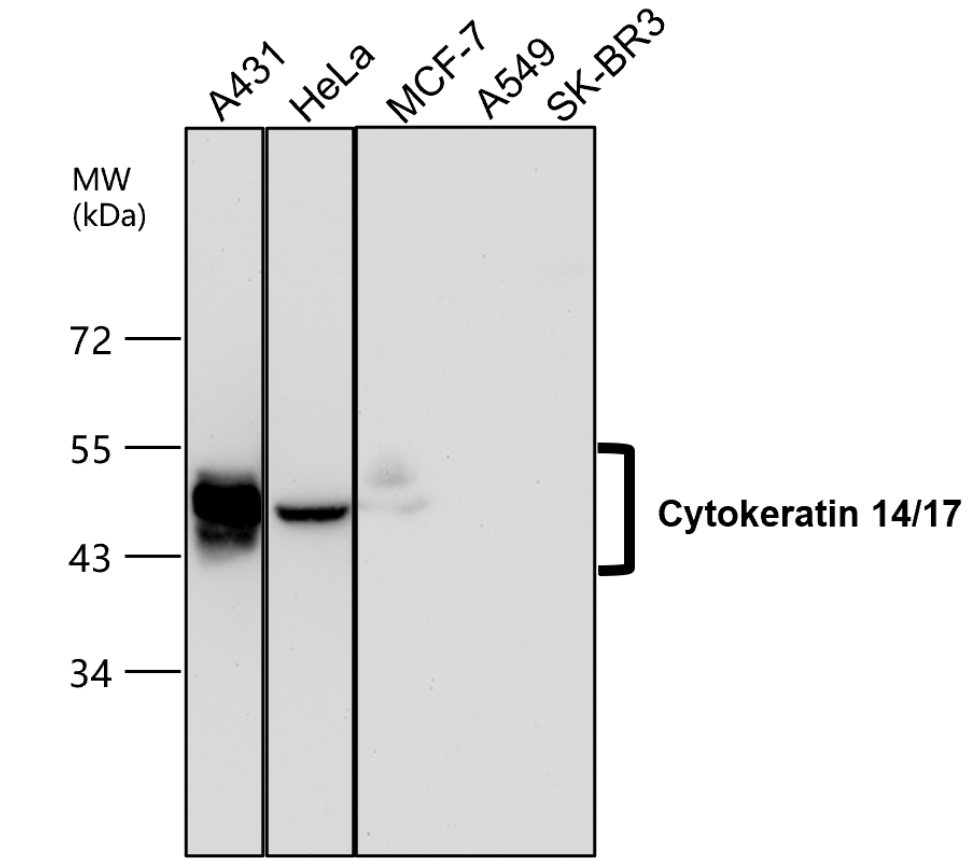 IR235-880 anti-Cytokeratin 14/17 antibody WB image IR235-880 anti-Cytokeratin 14/17 antibody WB image