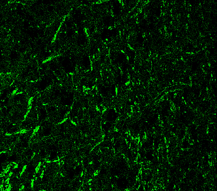 IR39-122 anti-Tau N-term antibody IHC image IR39-122 anti-Tau N-term antibody IHC image