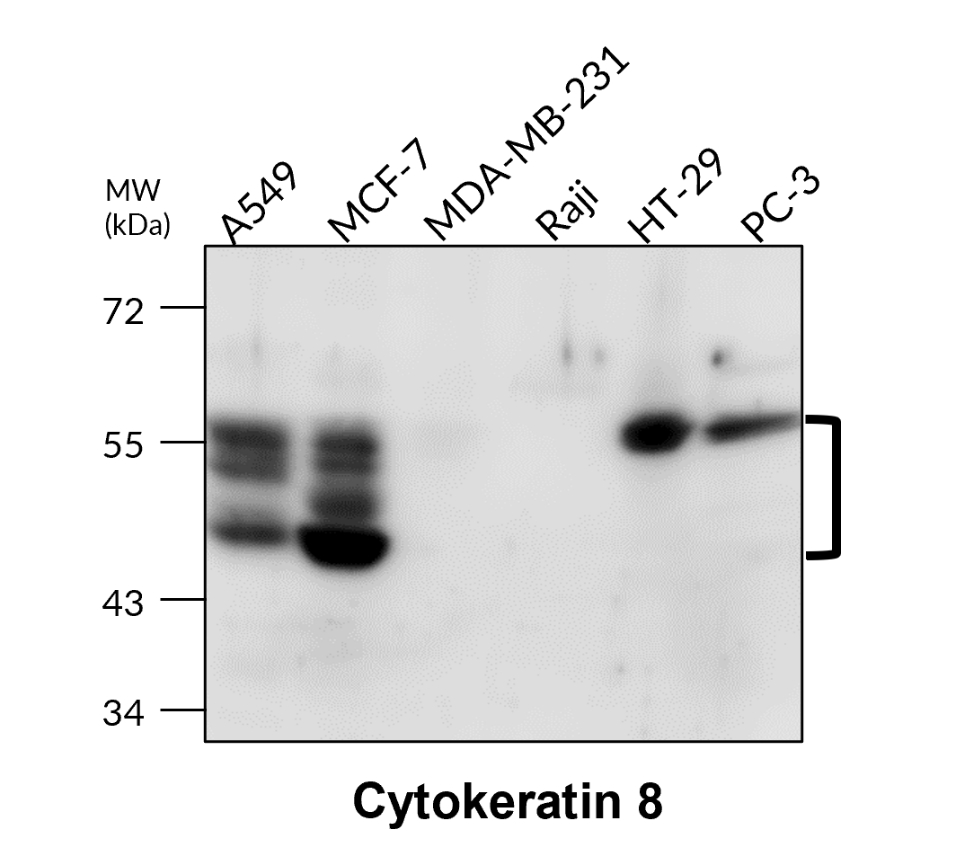 IR229-871 anti-Cytokeratin 8 antibody WB image IR229-871 anti-Cytokeratin 8 antibody WB image