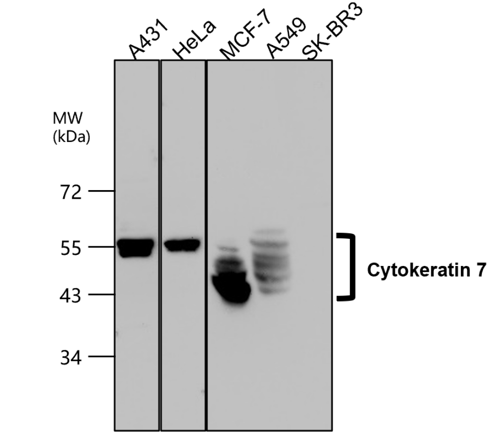 IR228-868 anti-Cytokeratin 7 antibody WB image IR228-868 anti-Cytokeratin 7 antibody WB image