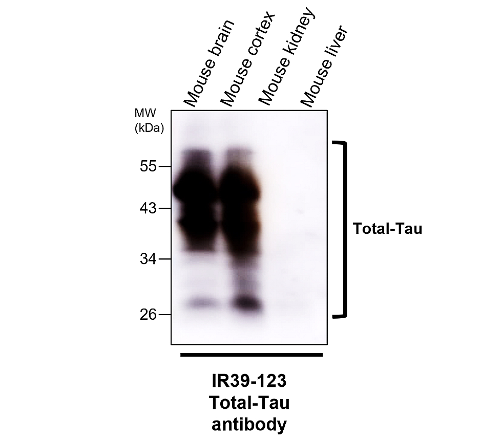 IR39-123 anti-Tau antibody WB image IR39-123 anti-Tau antibody WB image