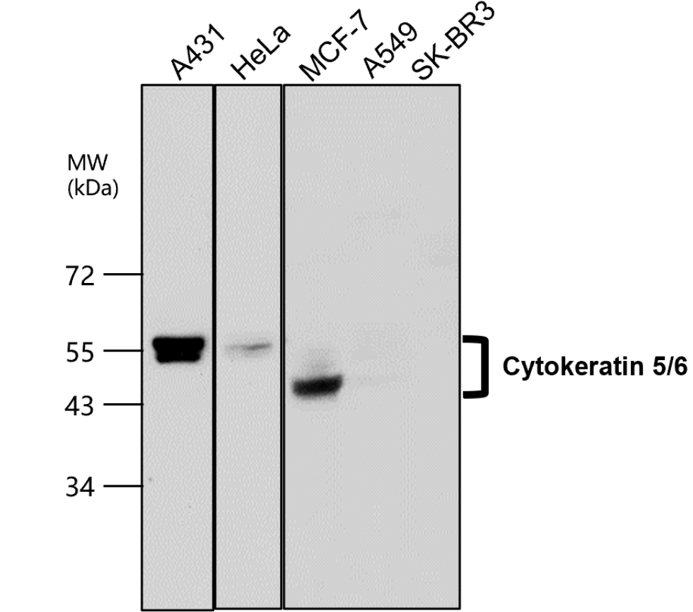 IR226-865 anti-Cytokeratin 5/6 antibody WB image IR226-865 anti-Cytokeratin 5/6 antibody WB image