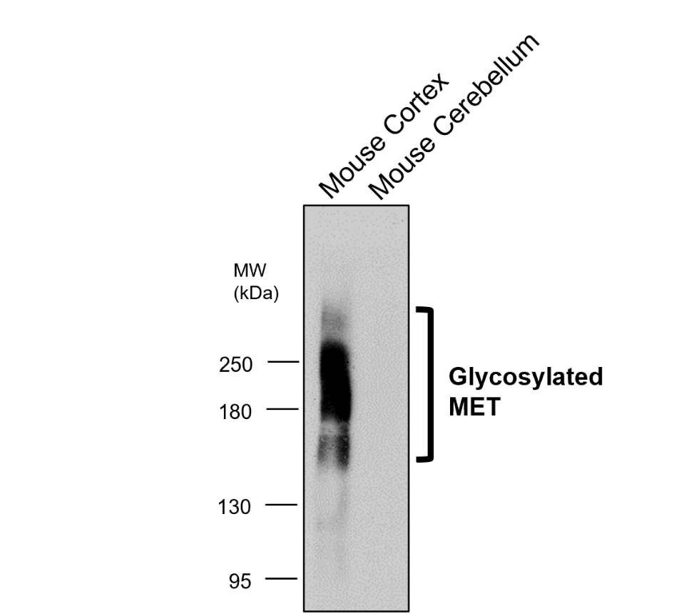 IR219-807 anti c-MET antibody WB image IR219-807 anti c-MET antibody WB image