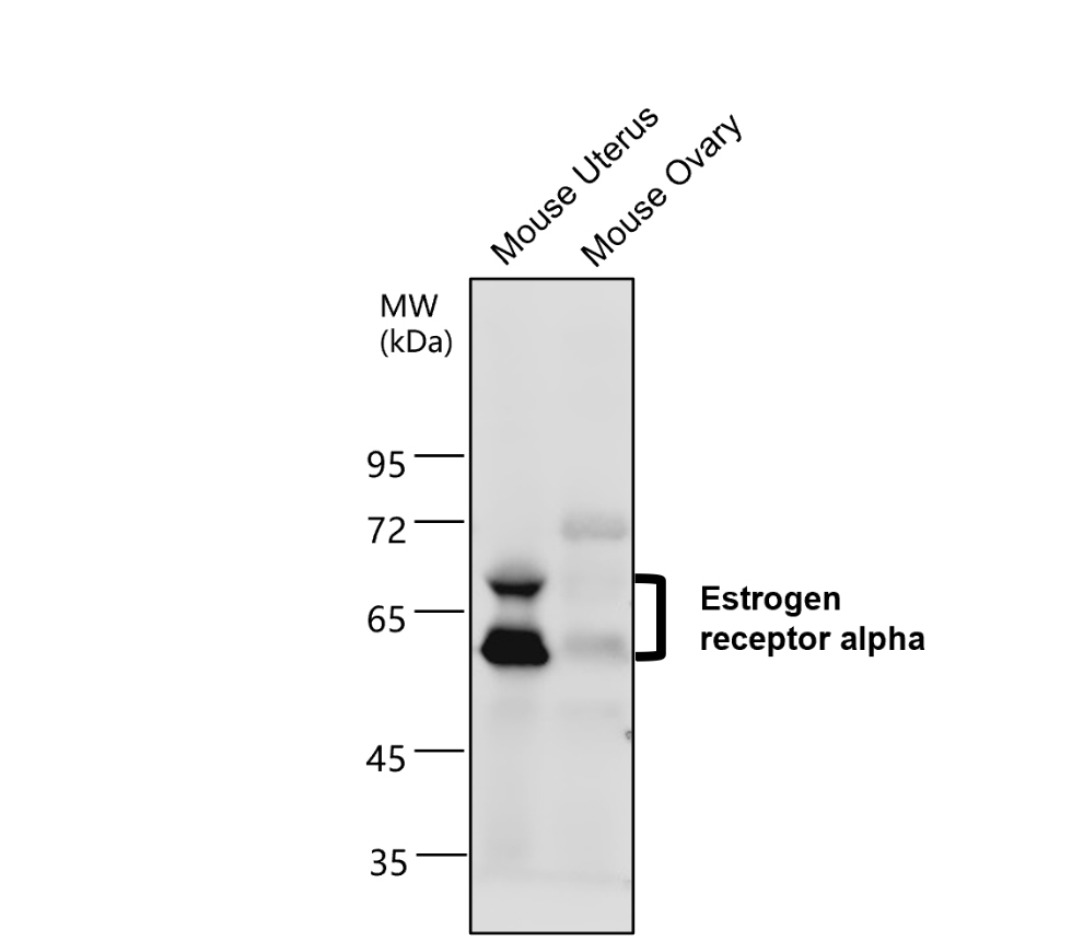 IR213-777 anti- Estrogen Receptor alpha antibody WB image IR213-777 anti- Estrogen Receptor alpha antibody WB image
