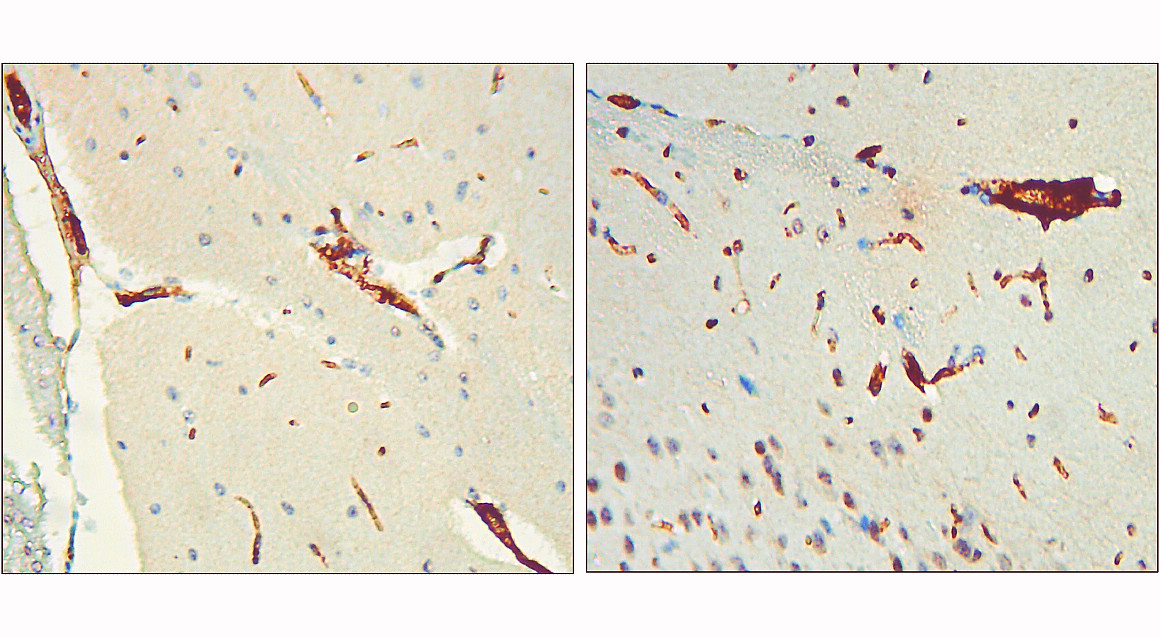 IR42-126 anti-Phospho-Tau (Thr217) antibody IHC image IR42-126 anti-Phospho-Tau (Thr217) antibody IHC image