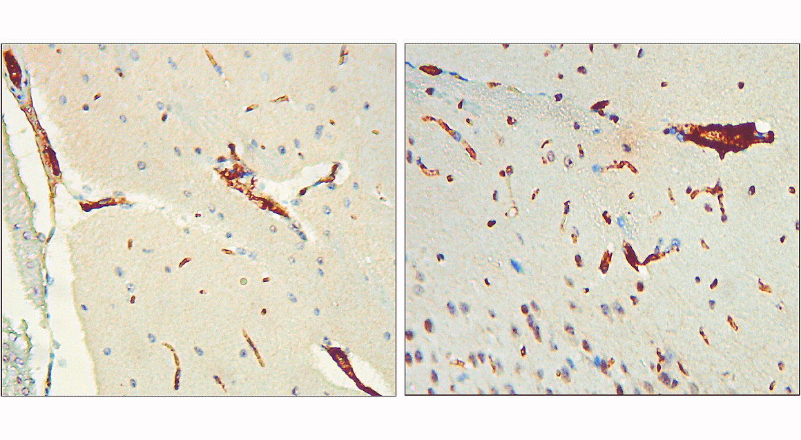 IR42-126 anti-Phospho-Tau (Thr217) antibody IHC image