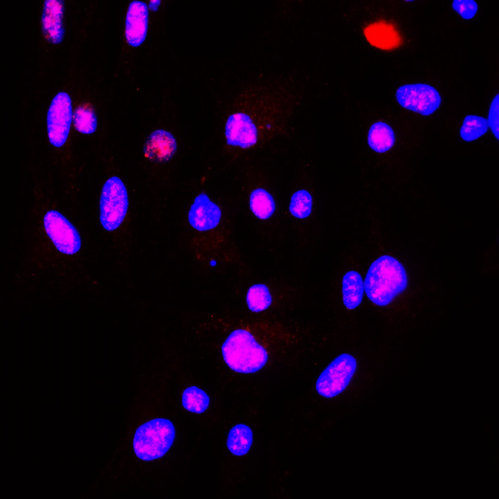 IR43-128 anti-alpha Synuclein antibody ICC/IF image IR43-128 anti-alpha Synuclein antibody ICC/IF image