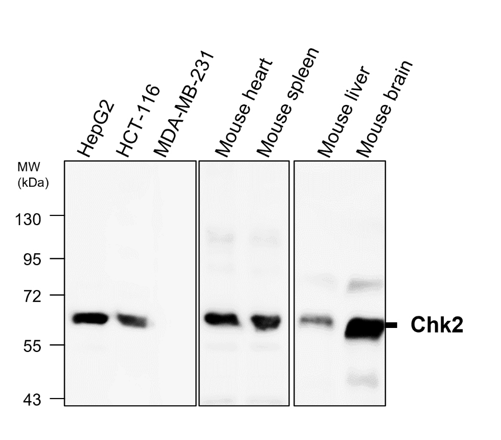 IR157-621 anti- Chk2 antibody WB image