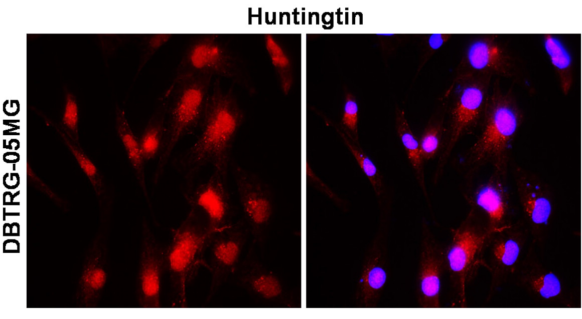 IR44-131 anti-Huntingtin antibody_DBTRG-05MG ICC/IF image IR44-131 anti-Huntingtin antibody_DBTRG-05MG ICC/IF image