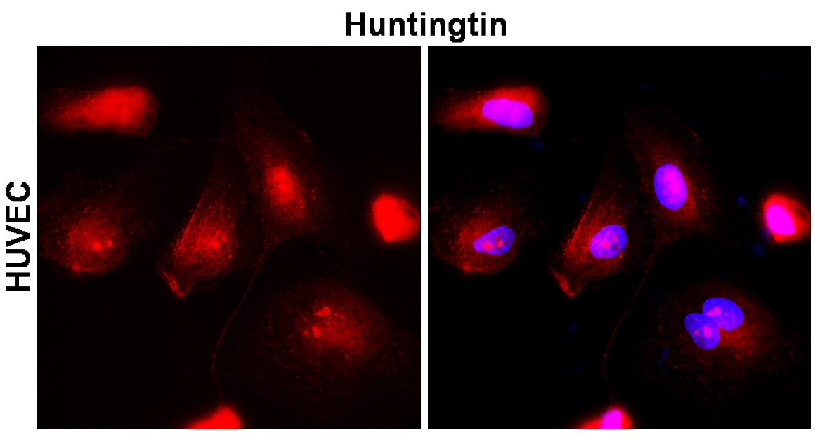 IR44-131 anti-Huntingtin antibody_HUVEC ICC/IF image IR44-131 anti-Huntingtin antibody_HUVEC ICC/IF image