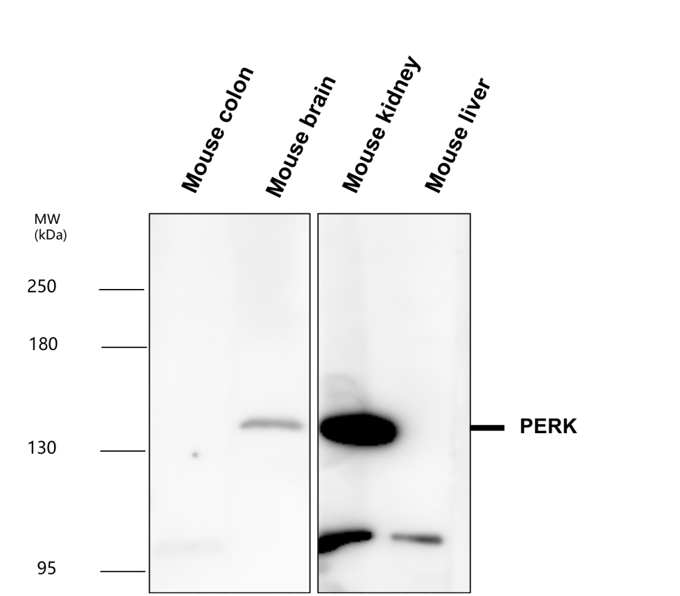 IR135-538 anti-PERK antibody WB image IR135-538 anti-PERK antibody WB image