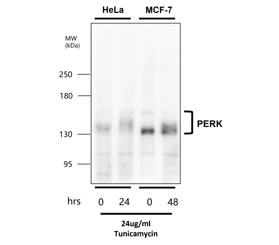IR135-538 anti-PERK antibody WB image IR135-538 anti-PERK antibody WB image