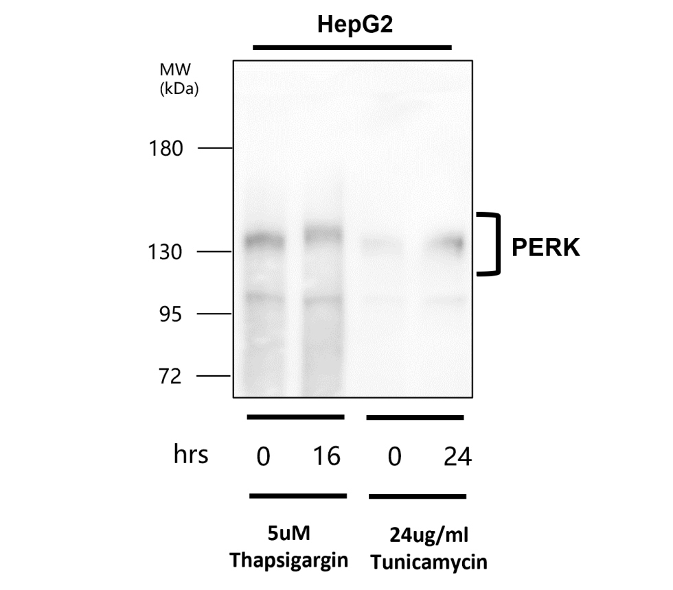 IR135-538 anti-PERK antibody WB image IR135-538 anti-PERK antibody WB image
