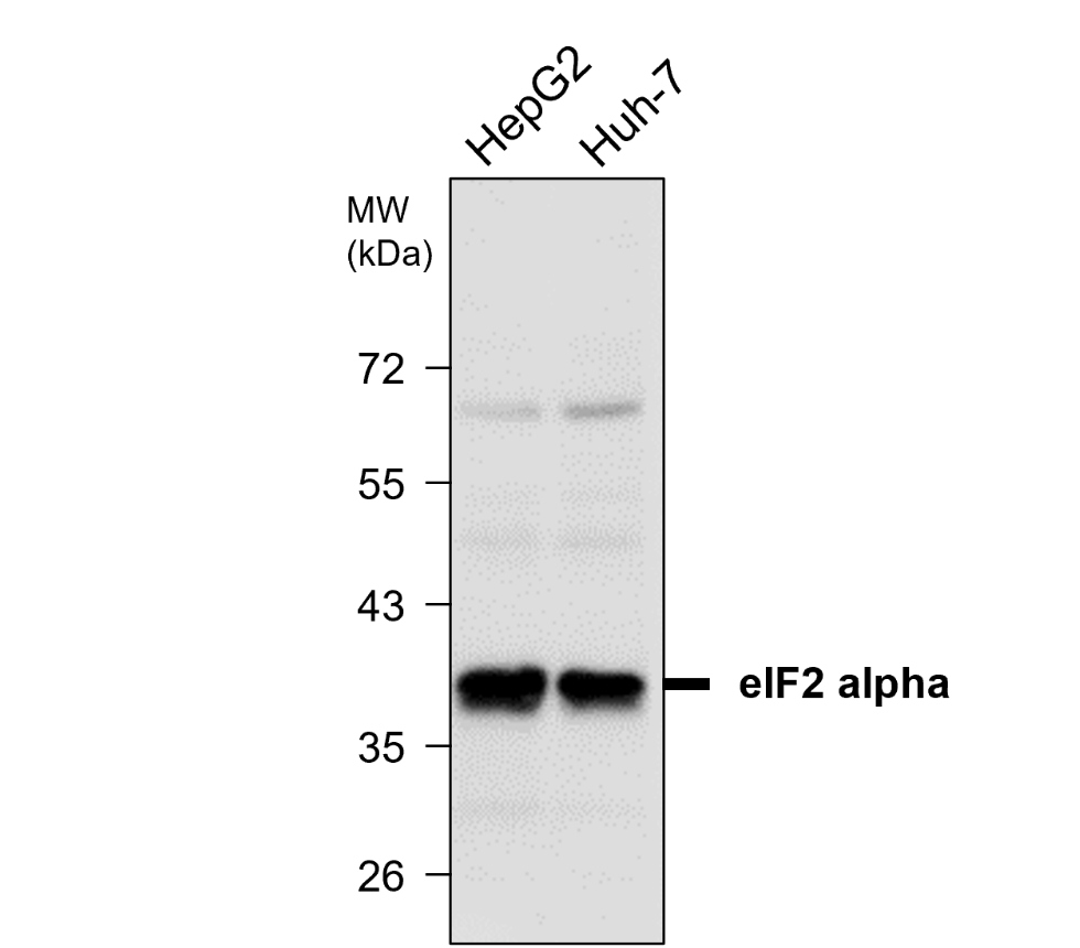 IR133-535 anti-eIF2 alpha antibody WB image IR133-535 anti-eIF2 alpha antibody WB image