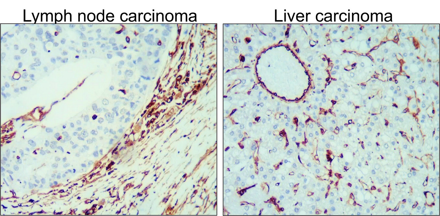 IR45-137 anti-Vimentin antibody IHC image