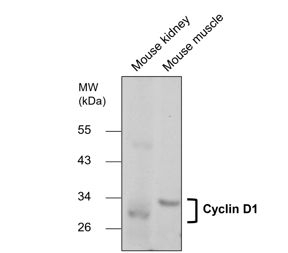 IR117-294 anti-Cyclin D1 antibody WB image IR117-294 anti-Cyclin D1 antibody WB image