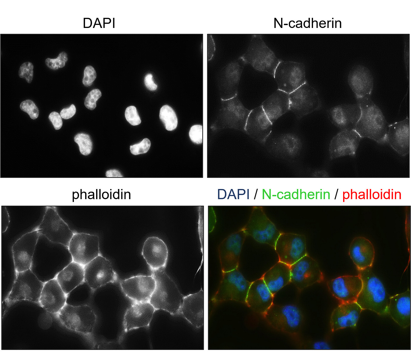 Customer feedback Image IR46-143 anti- N cadherin antibody ICC/IF image