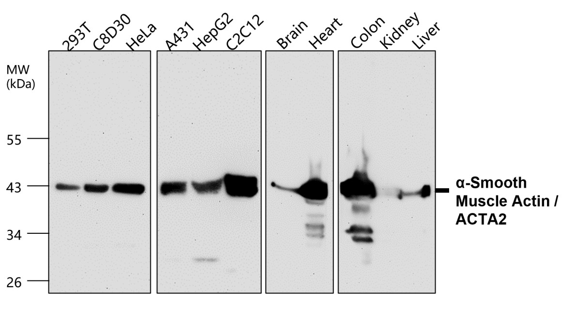 IR47-146 anti-α Smooth Muscle Actin antibody WB image IR47-146 anti-α Smooth Muscle Actin antibody WB image