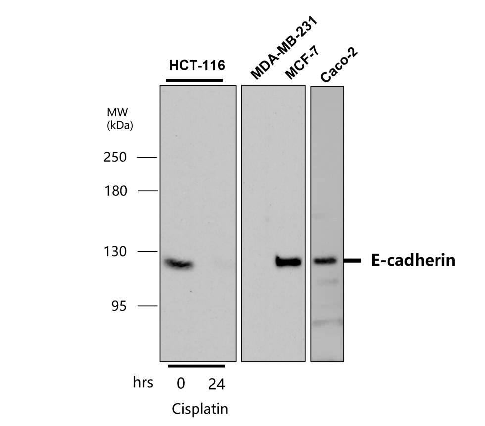 E-cadherin antibody E-cadherin antibody