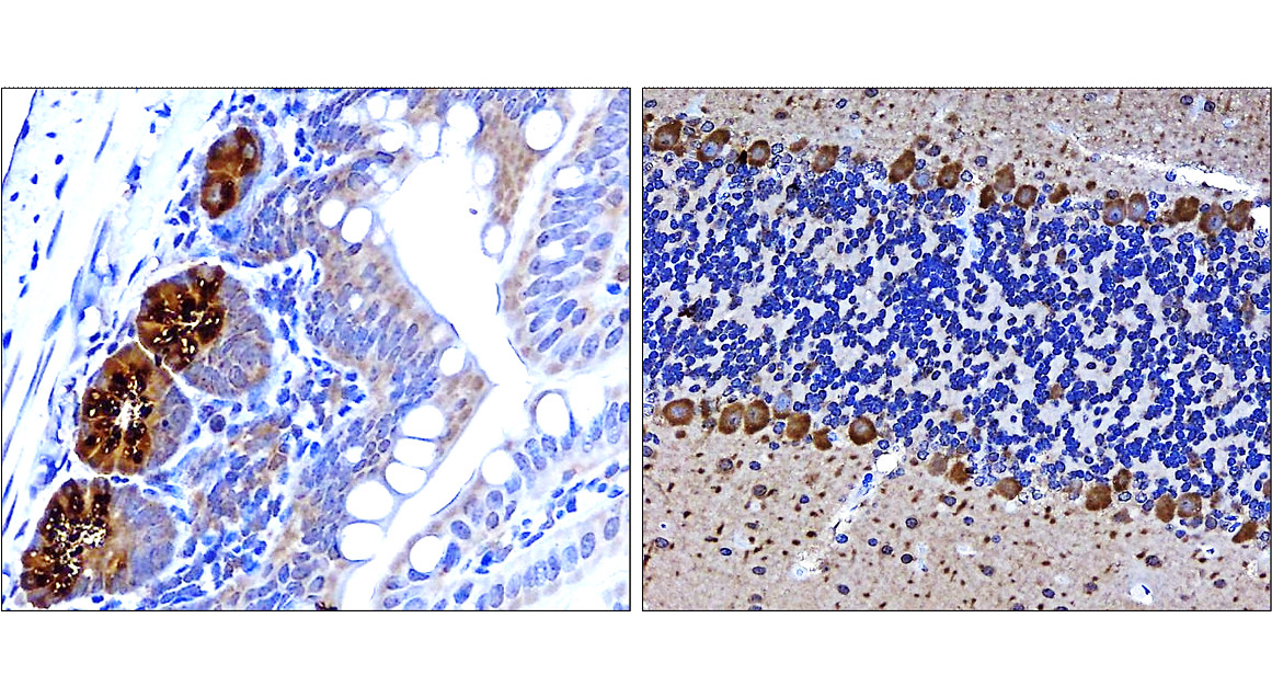 IR84-366 anti-LC3B antibody_mouse tissue IHC image IR84-366 anti-LC3B antibody_mouse tissue IHC image