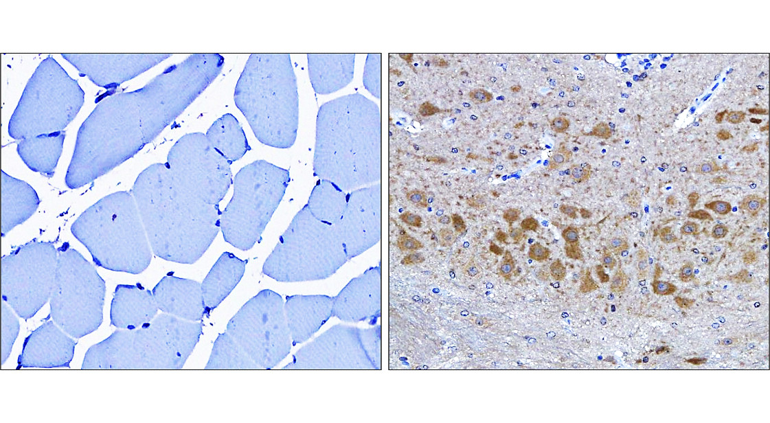 IR84-366 anti-LC3B antibody_mouse tissue IHC image IR84-366 anti-LC3B antibody_mouse tissue IHC image