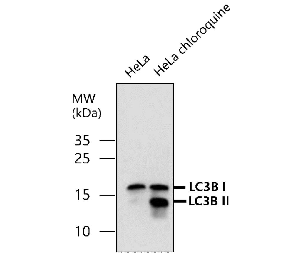 IR84-366 anti-LC3B antibody WB image IR84-366 anti-LC3B antibody WB image
