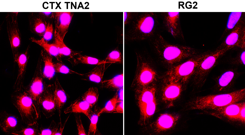 IR84-366 anti-LC3B antibody ICC/IF image
