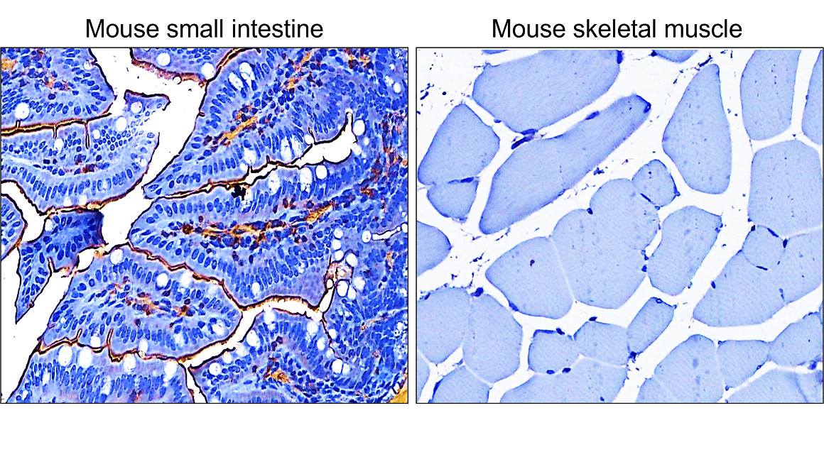 IR47-146 anti-α Smooth Muscle Actin antibody IHC image IR47-146 anti-α Smooth Muscle Actin antibody IHC image