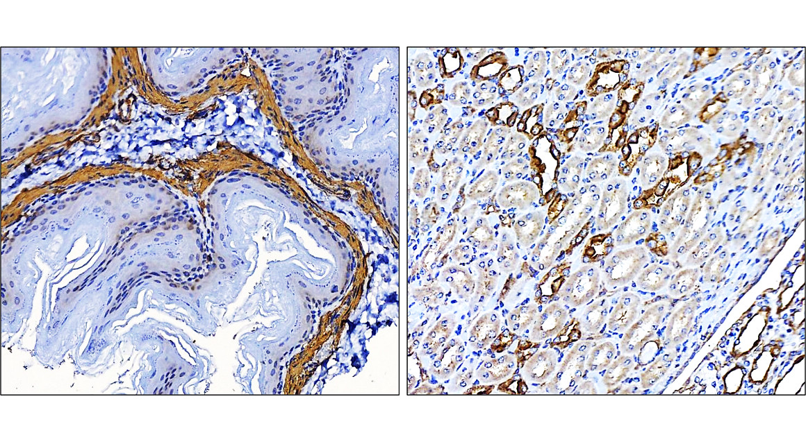IR47-146 anti-α Smooth Muscle Actin antibody IHC image