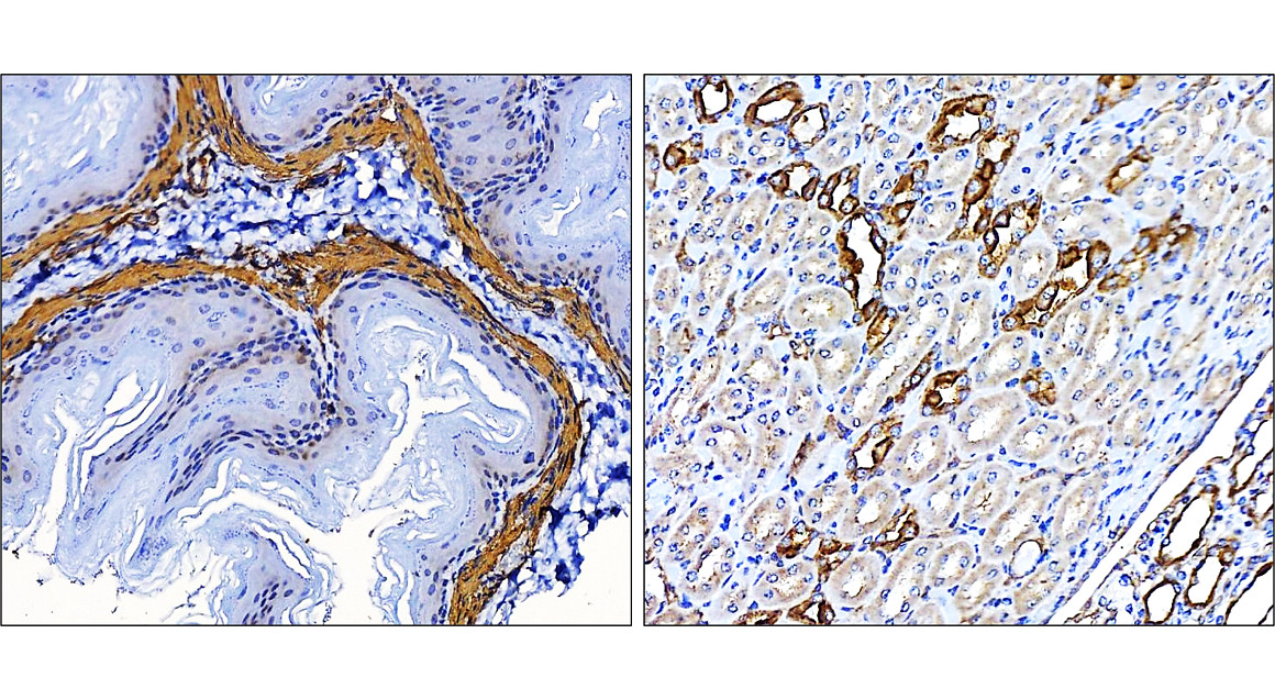 IR47-146 anti-α Smooth Muscle Actin antibody IHC image IR47-146 anti-α Smooth Muscle Actin antibody IHC image