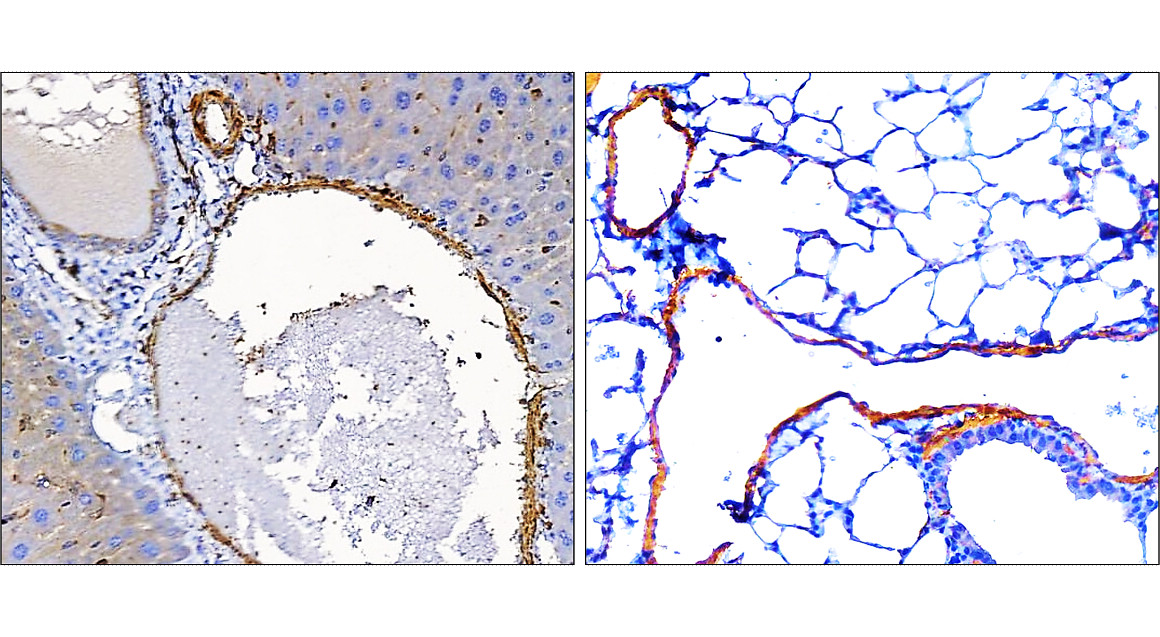 IR47-146 anti-α Smooth Muscle Actin antibody IHC image