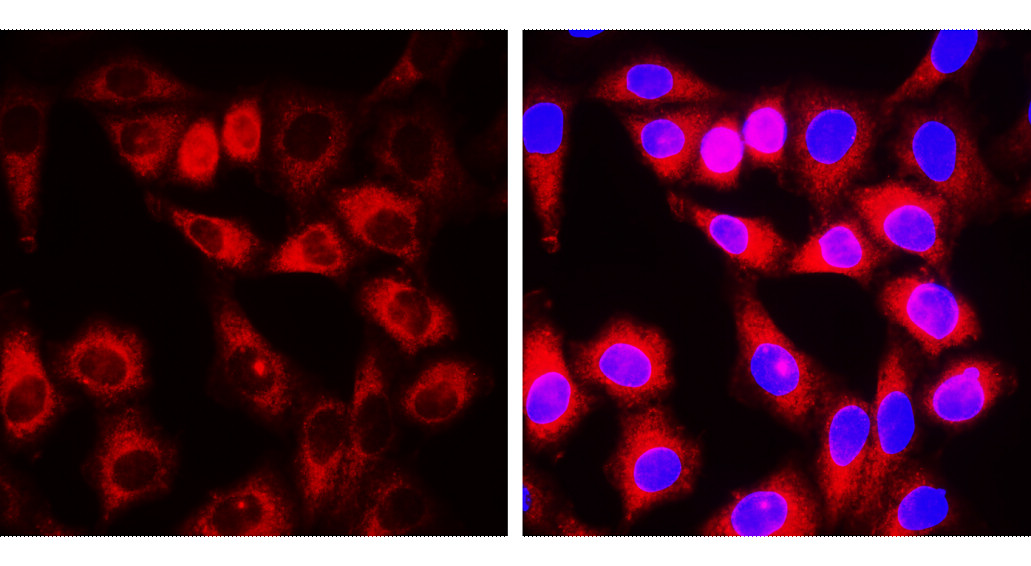 IR47-146 anti-α Smooth Muscle Actin antibody ICC/IF image