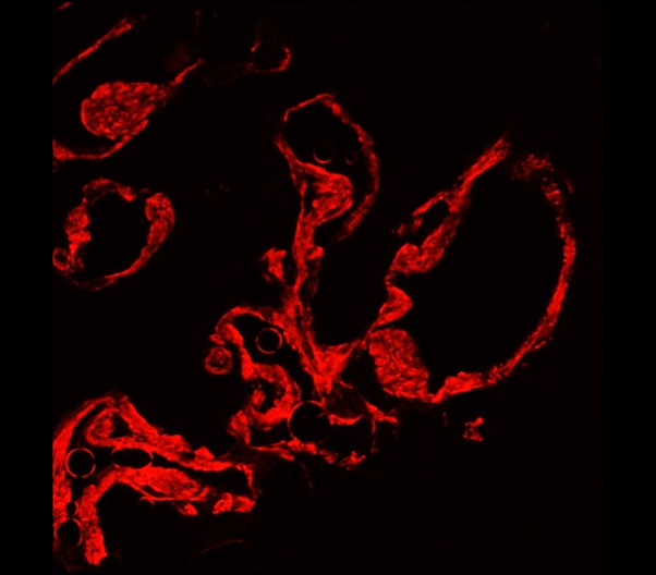 Customer feedback Image IR47-146 anti-α Smooth Muscle Actin antibody IHC image