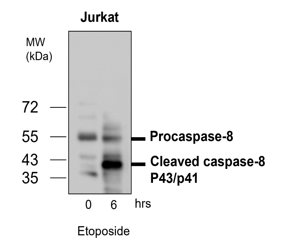 IR99-409 anti-Caspase8 antibody WB image IR99-409 anti-Caspase8 antibody WB image