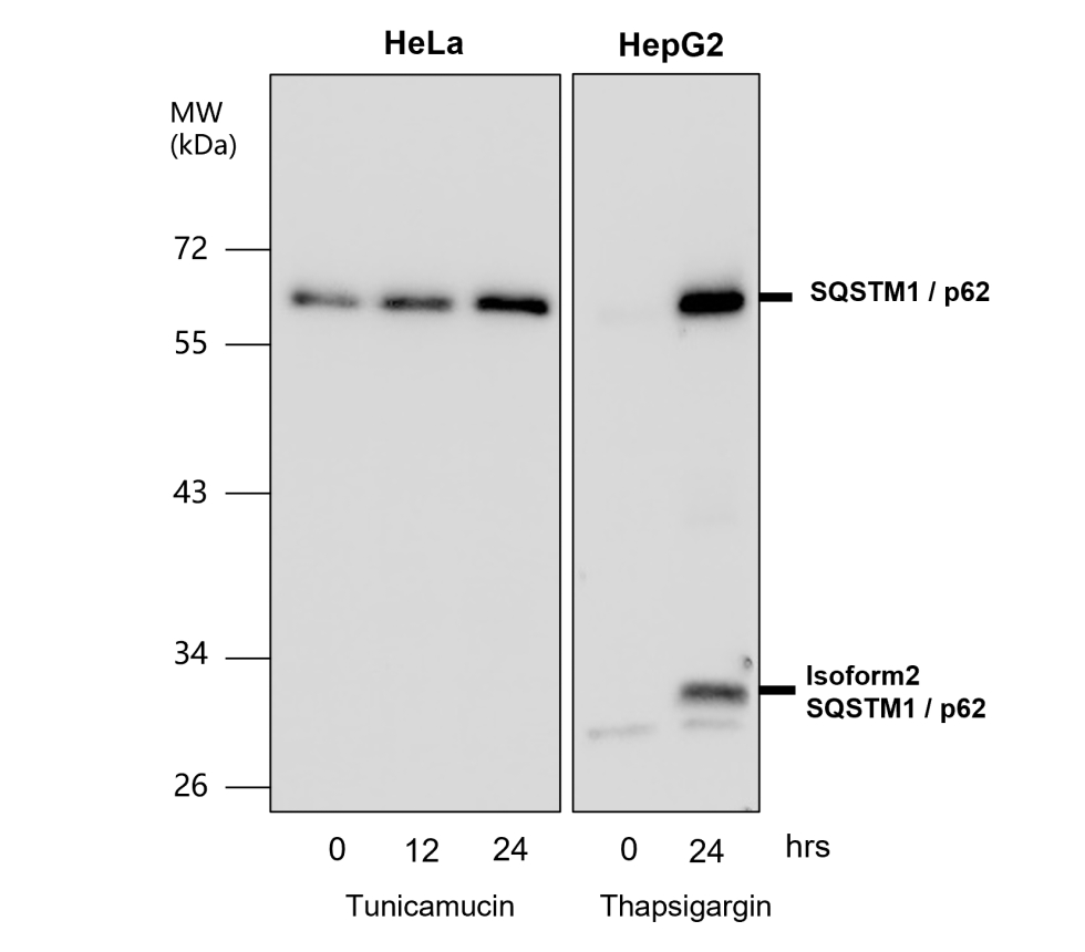 IR91-384 anti-SQSTM1 / p62 antibody
