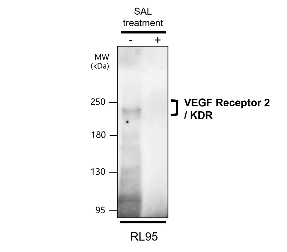 IR81-279 anti-VEGF Receptor 2 antibody WB image IR81-279 anti-VEGF Receptor 2 antibody WB image