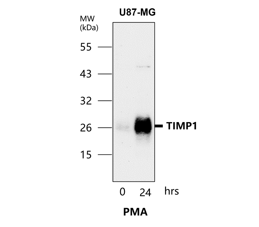 IR72-249 anti-TIMP1 antibody WB image IR72-249 anti-TIMP1 antibody WB image
