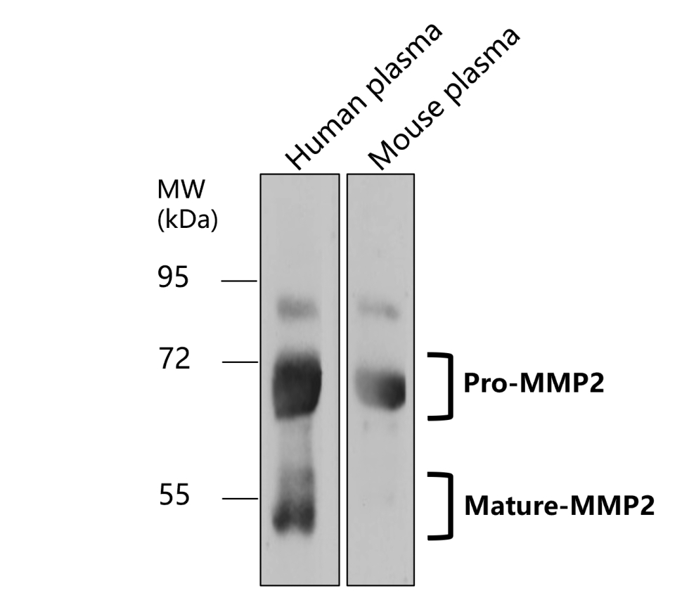 IR67-227 anti- MMP2 antibody WB image