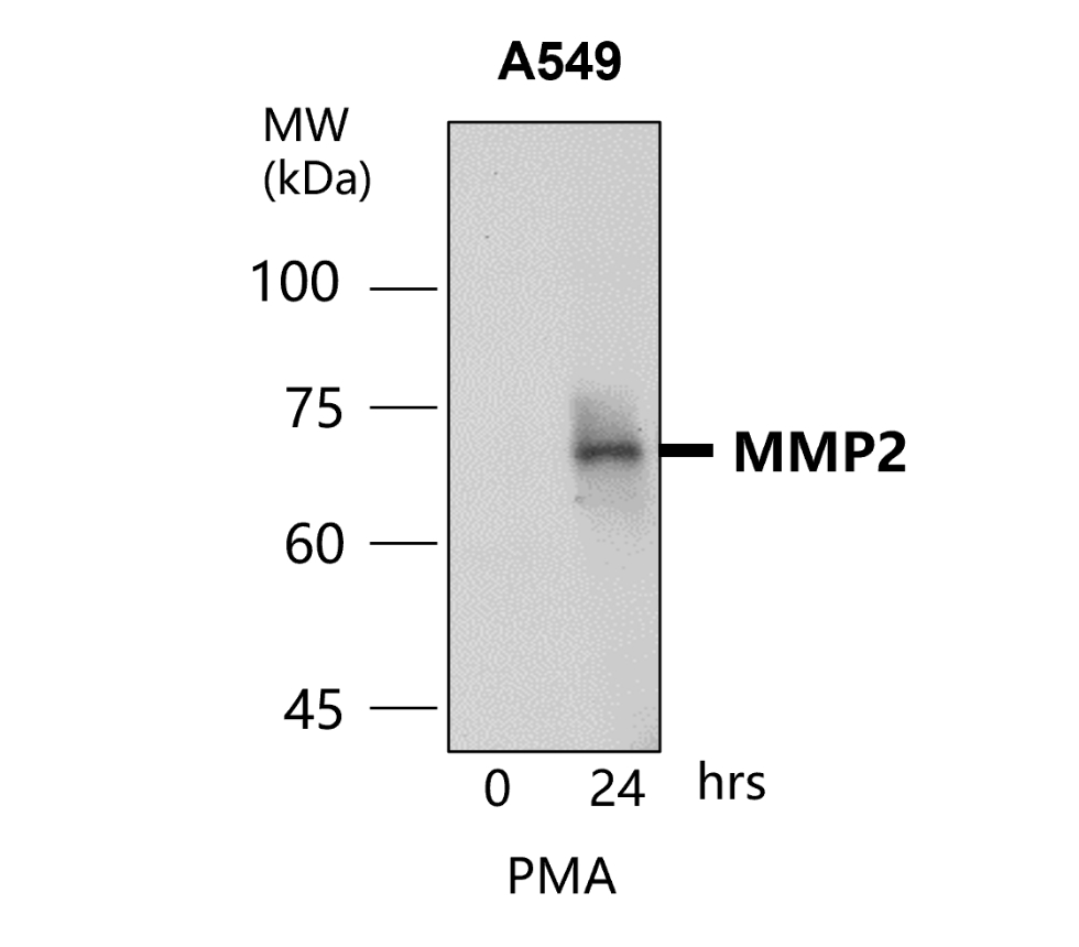 IR67-227 anti- MMP2 antibody WB image