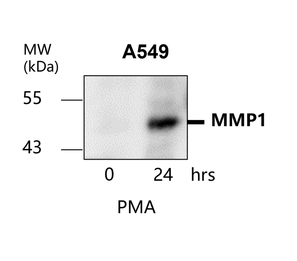IR66-225 anti-MMP1 antibody WB image IR66-225 anti-MMP1 antibody WB image
