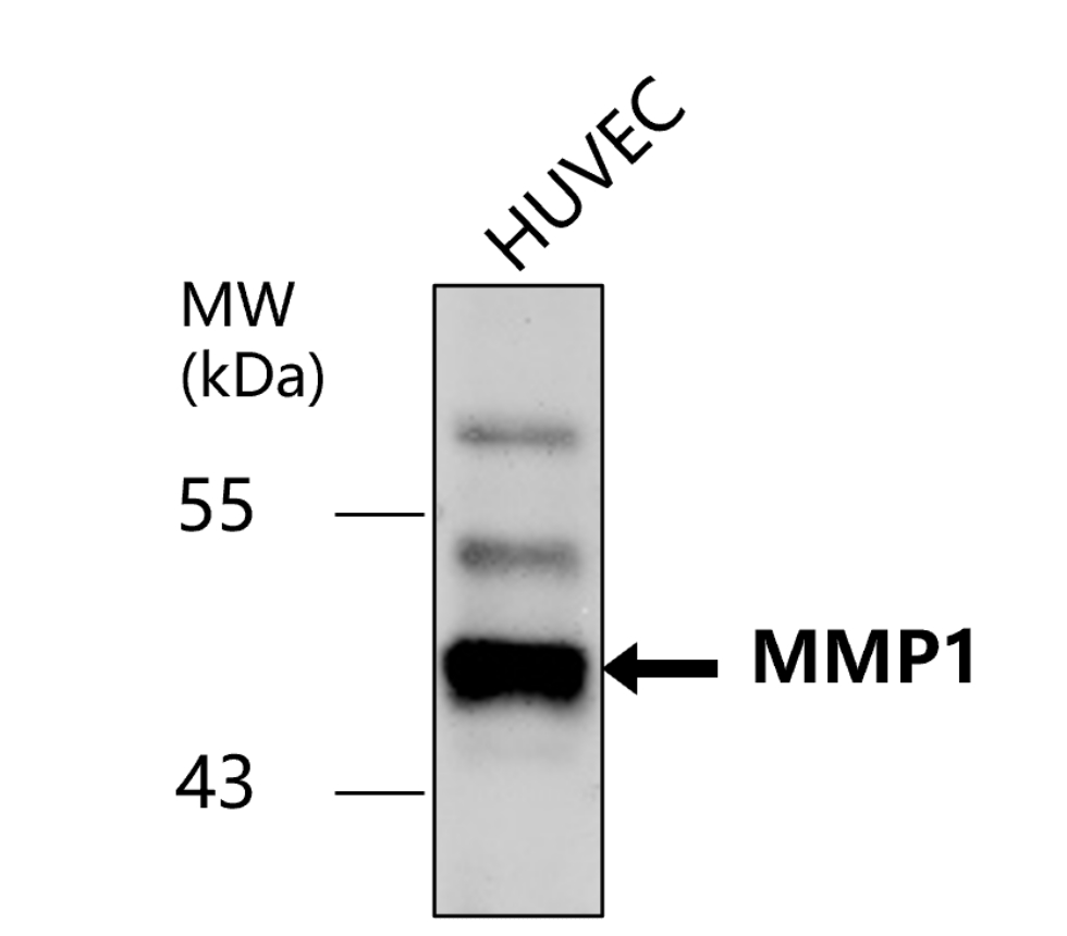 IR66-225 anti-MMP1 antibody WB image IR66-225 anti-MMP1 antibody WB image