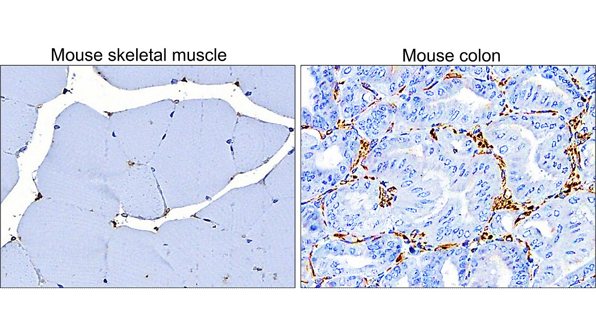 IR45-137 anti-Vimentin antibody IHC image